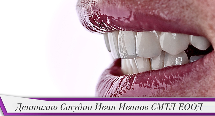Дентално Студио Иван Иванов СМТЛ