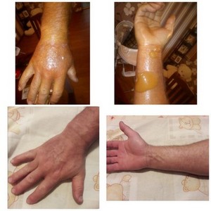 ЕКОСИТИ 2010 ЕООД