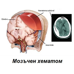 Д-р Борислав Калнев