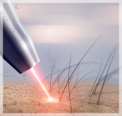 Милагрос Лазерен Център